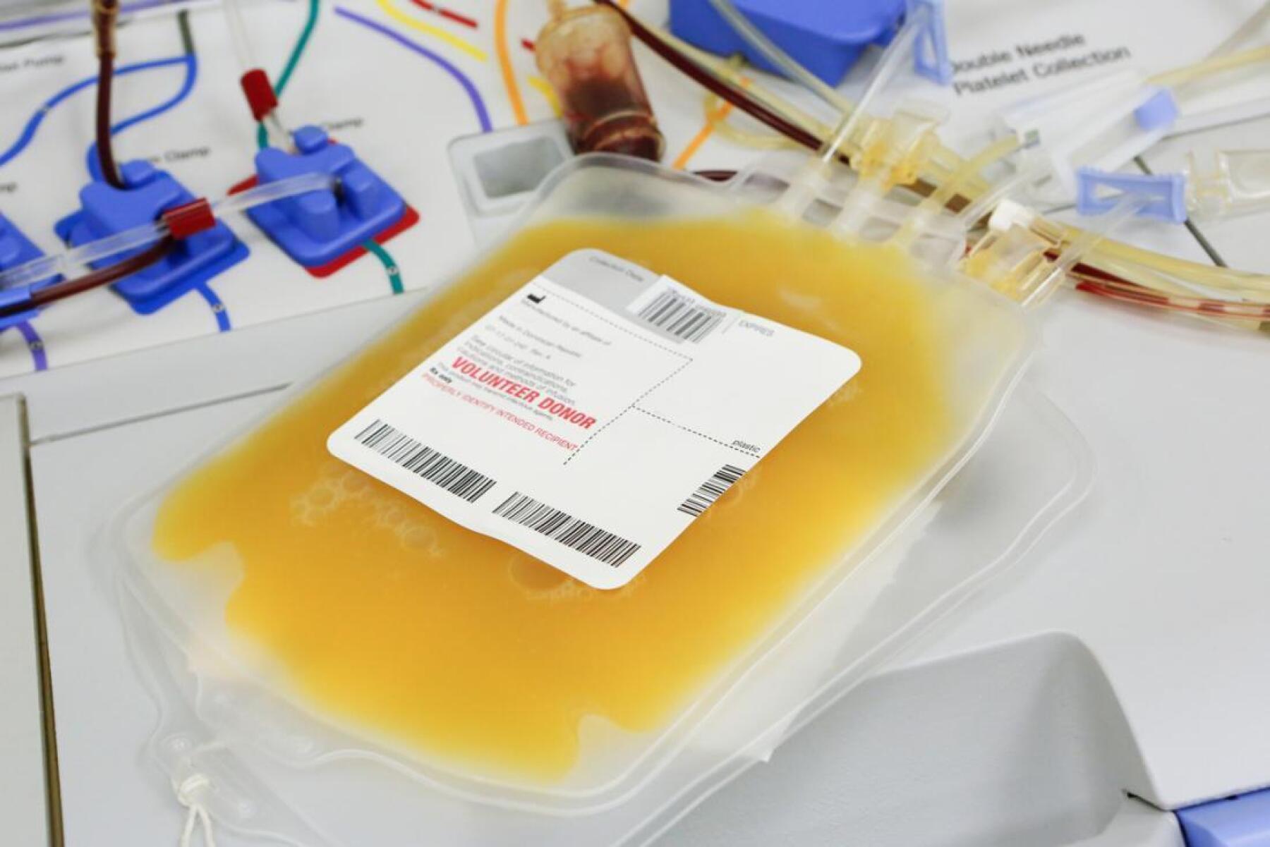 Transfusion De Plasma Pourquoi Transfusion Sanguine Fiche Technique Transfusion De Plasma Pourquoi Transfusion Sanguine Fiche Technique